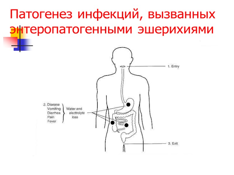 Патогенез инфекций, вызванных         энтеропатогенными эшерихиями